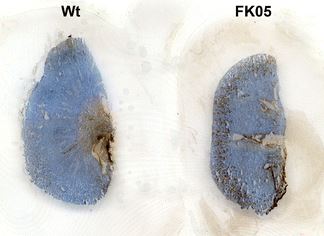 Fabry mouse kidney